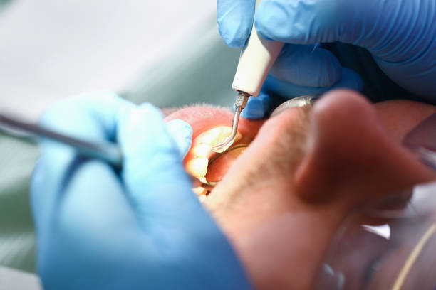 Best Emergency Denture Repair in Vineyard, CA
